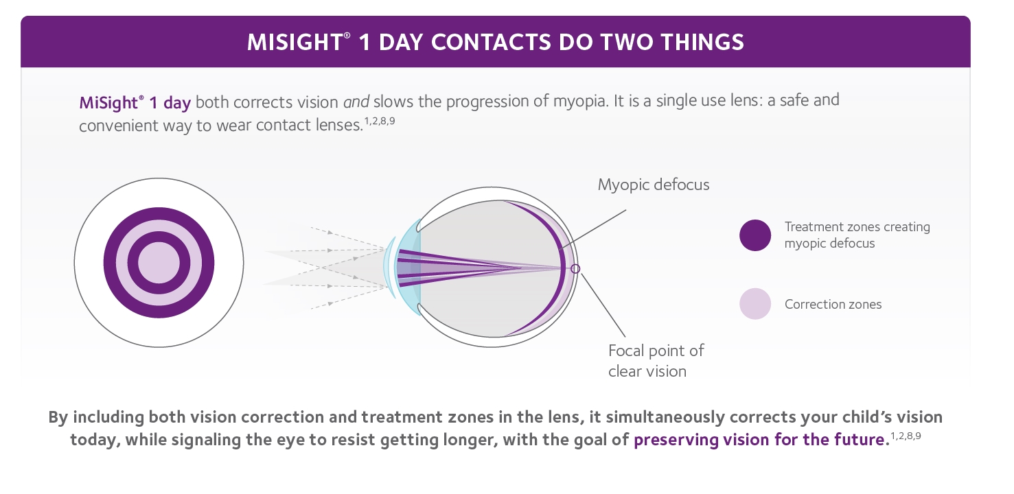 MySight contact Lenses graphic